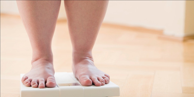 احتمال واریس در افراد مبتلا به اضافه وزن یا چاقی