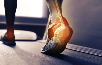 علت گرفتگی عضلات پا در هنگام راه رفتن